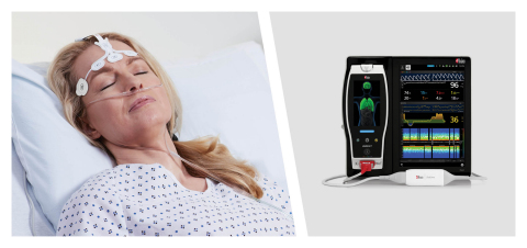 Masimo Root® with SedLine® Brain Function Monitoring (Photo: Business Wire)