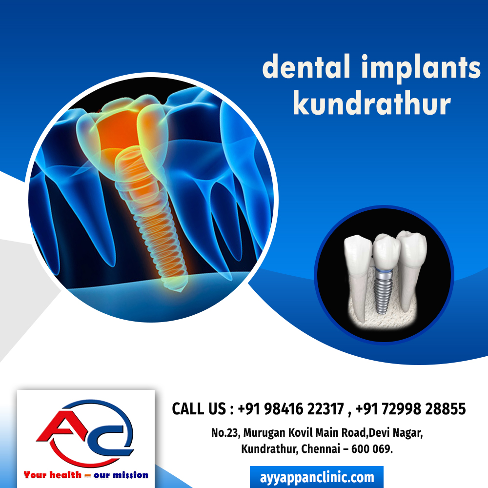 dental implants kundrathur